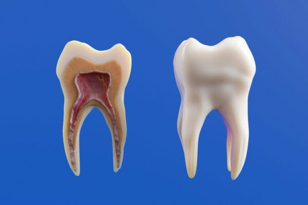 Tooth Pain From Sinus Infection:
