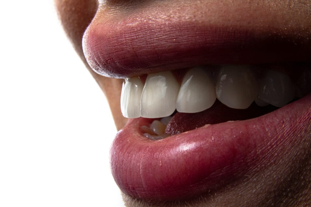 Close-up of upper front teeth and lips, illustrating the dental structures discussed in the context of sinus-related tooth pain